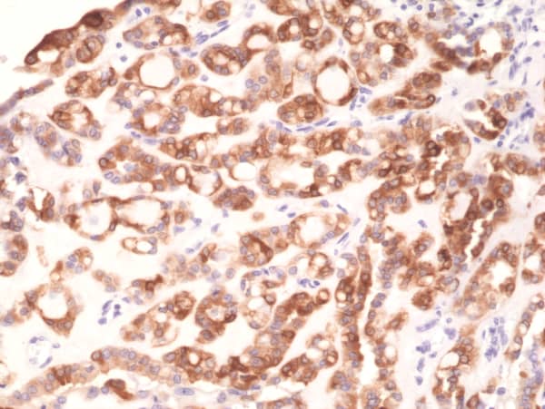Immunohistochemistry: Thyroid Peroxidase Antibody (RM368) [NBP2-77429] - Immunohistochemical staining of formalin fixed and paraffin embedded human thyroid tissue section using NBP2-77429.