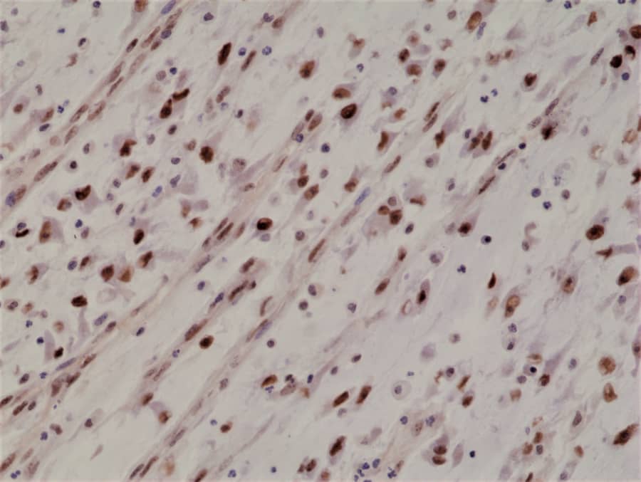 Immunohistochemistry-Paraffin: MyoD Antibody (RM369) [NBP2-77430] - Mouse skeletal muscle tissue lysate using anti-MyoD1 rabbit monoclonal antibody (Clone RM369) at a 1:2000 dilution.