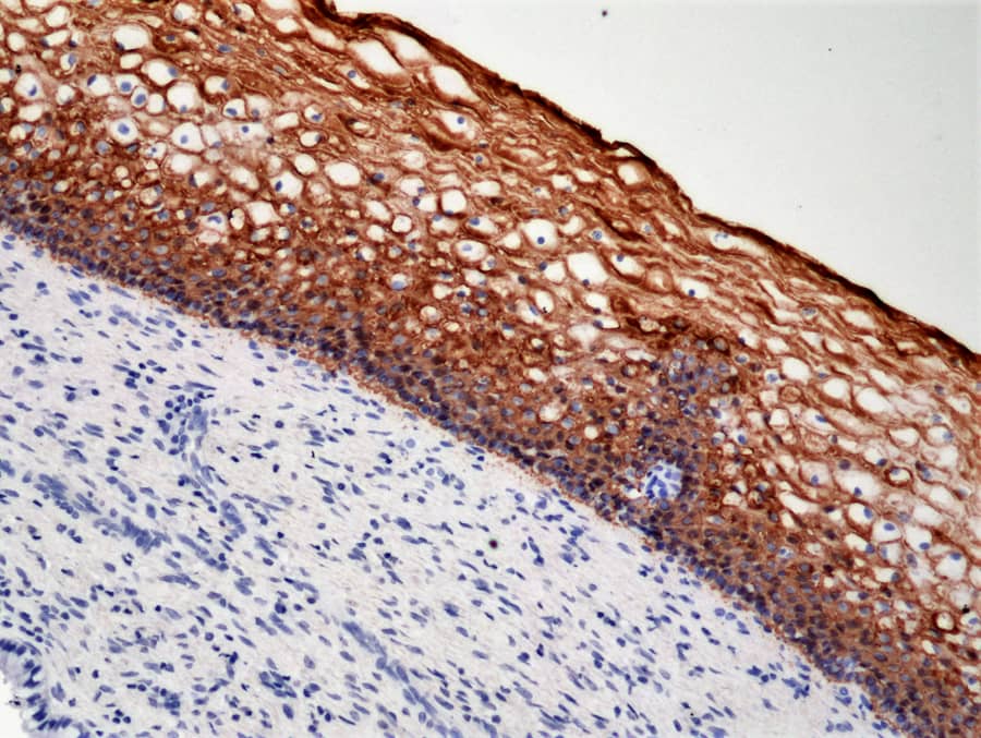 Immunohistochemistry-Paraffin: Cytokeratin 5/6 Antibody (RM341) [NBP2-77439] - Immunohistochemical staining of formalin fixed and paraffin embedded human cervix tissue section using anti-CK-5/CK-6 rabbit monoclonal antibody (Clone RM341) at a 1:1000 dilution.
