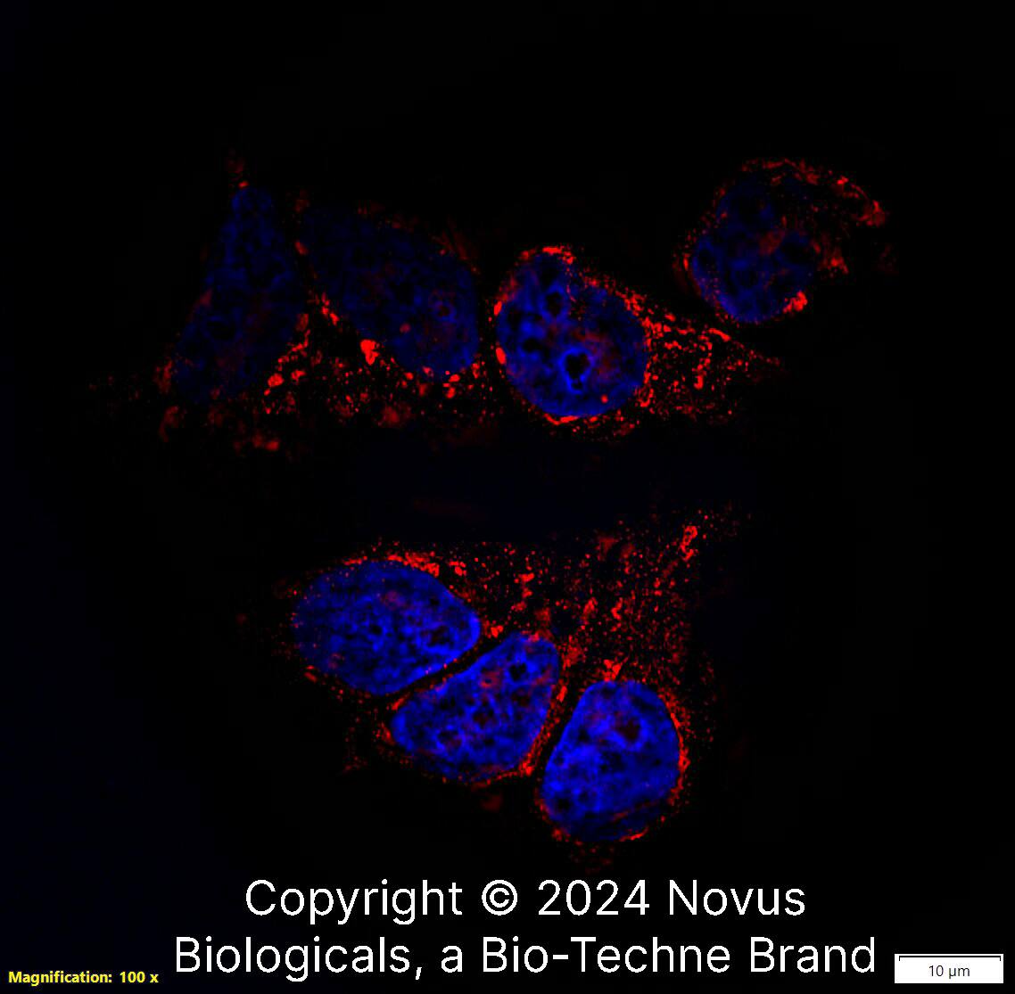 TSG101 was detected in immersion fixed MCF7 human breast cancer cell line using Rabbit anti-TSG101 Antigen Affinity Purified Polyclonal Antibody conjugated to Biotin (Catalog # NBP2-77452B) at 5 µg/mL overnight at 4C. Cells were stained using Streptavidin conjugated to DyLight 550 (red) and counterstained with DAPI (blue). Cells were imaged using a 100X objective and digitally deconvolved. 