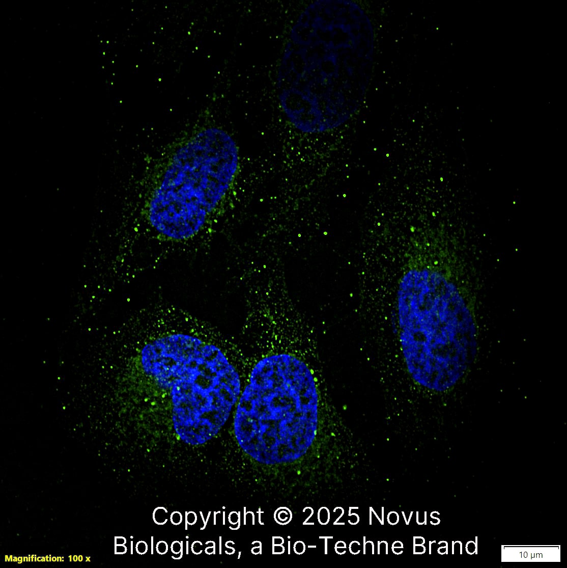Tensin 1 was detected in immersion fixed U-2 OS human osteosarcoma cell line using Rabbit anti-Tensin 1 Antigen Affinity-purified Polyclonal Antibody conjugated to Alexa Fluor® 488 (Catalog # NBP2-78783AF488) (green) at 10 µg/mL overnight at 4C.  Cells were counterstained with DAPI (blue). Cells were imaged using a 100X objective and digitally deconvolved.