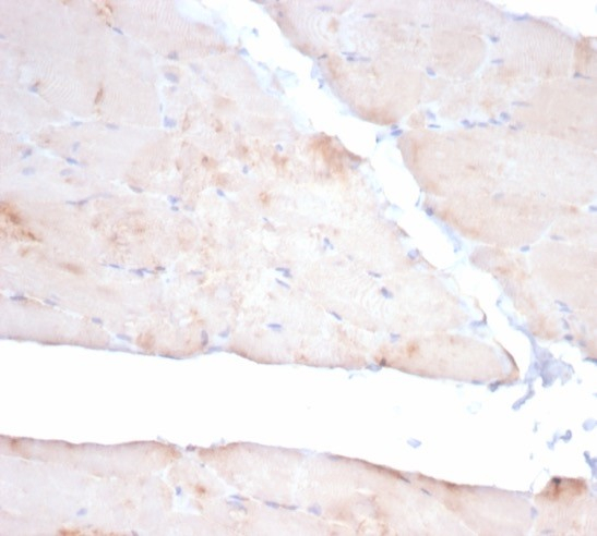 Formalin-fixed, paraffin-embedded dog skeletal muscle stained with Alpha Actinin 2 antibody (ACTN2/3293).