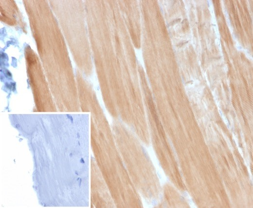 Formalin-fixed, paraffin-embedded human Skeletal Muscle stained with Alpha Actinin 2 antibody (ACTN2/3293). Inset: PBS instead of primary antibody; secondary only negative control.