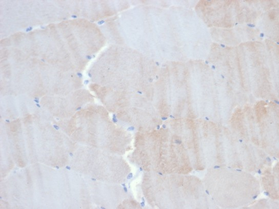 Formalin-fixed, paraffin-embedded horse skeletal muscle stained with Alpha Actinin 2 antibody (ACTN2/3293).