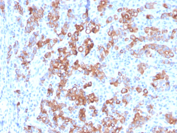 Formalin-fixed, paraffin-embedded human Adrenal stained with TIM-3 antibody (TIM3/3113).