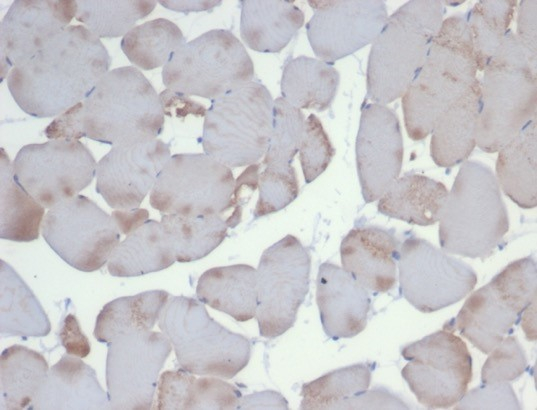 Formalin-fixed, paraffin-embedded cow skeletal muscle stained with Alpha Actinin 2 antibody (ACTN2/3293).