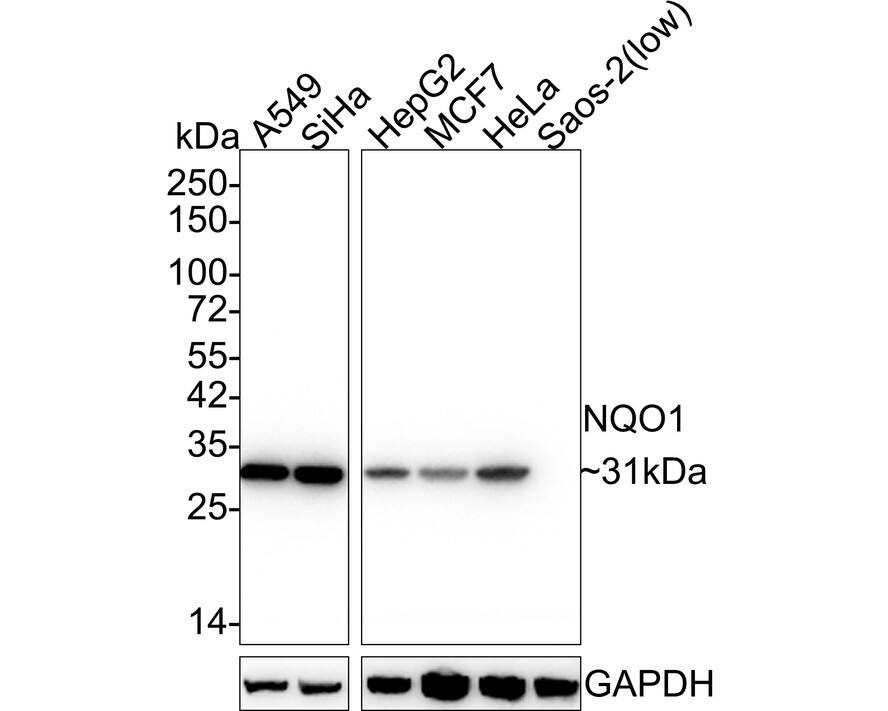 Western blot analysis on different lysates with NBP2-80395 at 1/2,000 dilution. Lane 1: A549 cell lysate Lane 2: SiHa cell lysate Lane 3: HepG2 cell lysate Lane 4: MCF7 cell lysate Lane 5: HeLa cell lysate Lane 6: Saos-2 cell lysate (low expression) Lysates/proteins at 30 µg/Lane. Predicted band size: 31 kDa Observed band size: 31 kDa Exposure time: 5 seconds; 4-20% SDS-PAGE gel. Proteins were transferred to a PVDF membrane and blocked with 5% NFDM/TBST for 1 hour at room temperature. NBP2-80395 at 1/2,000 dilution was used in 5% NFDM/TBST at 4℃ overnight. Goat anti-Mouse IgG [HRP] at 1/50,000 dilution was used for 1 hour at room temperature.
