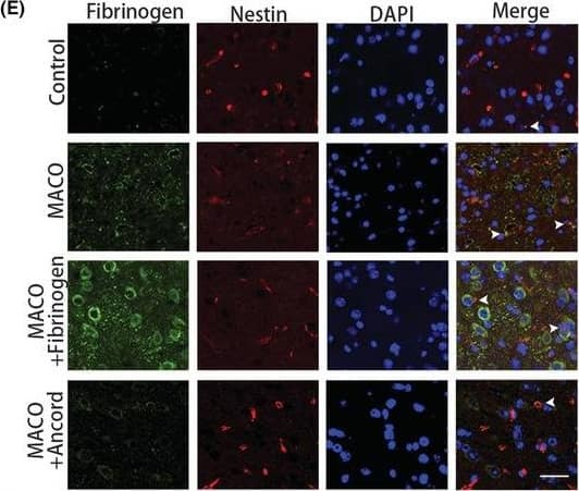Fibrinogen deposition after ischemia. (A) Fibrinogen immunostaining (green) in the peri‐infarct areas at 1, 3, 7, and 14 days after MCAO and uninjured mice. Scale bar, 50 μm. (B) Quantification of fibrinogen immunoreactivity in the peri‐infarct areas per area. (C) Scheme illustrating MCAO on ancrod‐administered mice. (D) Enzyme‐linked immunosorbent assay quantification of fibrinogen. (E) Nestin (red) and fibrinogen (green) immunostainings in the peri‐infarct areas 3 days after MCAO. White arrowheads show the colocalization of nestin and fibrinogen. Scale bar, 25 μm. (F) GFAP (red) and fibrinogen (green) immunostainings in the peri‐infarct areas 3 days after MCAO. White arrowheads show the colocalization of GFAP and fibrinogen. Scale bar, 25 μm. (G) Iba1 (red) and fibrinogen (green) immunostainings in the peri‐infarct areas 3 days after MCAO. White arrowheads show the colocalization of Iba1 and fibrinogen. Scale bar, 25 μm. N = 6 mice. Data are presented as mean +/- SEM, one‐way ANOVA, *p < 0.05, **p < 0.01, ***p < 0.001. Image collected and cropped by CiteAb from the following open publication (//pubmed.ncbi.nlm.nih.gov/36756722), licensed under a CC-BY license. Not internally tested by Novus Biologicals.