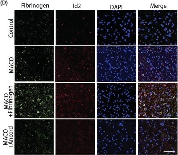 miR‐128‐3p mediates OPC differentiation by targeting fibrinogen‐BMP signaling. (A) Immunoblot analysis for Lef1 and P‐Smad1/5 after MCAO treated with fibrinogen or ancrod. (B and C) Quantification of Lef1 and P‐Smad1/5 expression. N = 6 mice. (D) Id2 (red) and fibrinogen (green) immunostaining. Scale bar, 50 μm. (E) Quantification of Id2 immunoreactivity. N = 6 mice. (F) Comparison of miRNAs expression in fibrinogen‐treated OPCs and untreated OPCs by miRNAs sequencing. N = 3 per group. (G) Venn diagram displaying miR‐128‐3p computationally predicted targets by three different prediction algorithms: targetScan, starbase, and miRWalk. (H) The verification of miR‐128‐3p relative expression by qRT‐PCR analysis. N = 6 per group. Data are presented as mean +/- SEM, one‐way ANOVA or unpaired Student's t‐test, **p < 0.01, ***p < 0.001. Image collected and cropped by CiteAb from the following open publication (//pubmed.ncbi.nlm.nih.gov/36756722), licensed under a CC-BY license. Not internally tested by Novus Biologicals.
