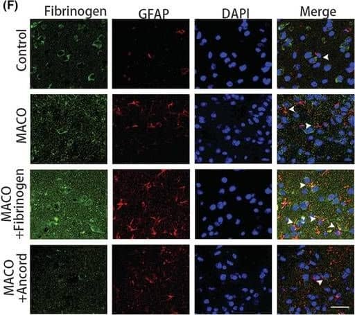 Fibrinogen deposition after ischemia. (A) Fibrinogen immunostaining (green) in the peri‐infarct areas at 1, 3, 7, and 14 days after MCAO and uninjured mice. Scale bar, 50 μm. (B) Quantification of fibrinogen immunoreactivity in the peri‐infarct areas per area. (C) Scheme illustrating MCAO on ancrod‐administered mice. (D) Enzyme‐linked immunosorbent assay quantification of fibrinogen. (E) Nestin (red) and fibrinogen (green) immunostainings in the peri‐infarct areas 3 days after MCAO. White arrowheads show the colocalization of nestin and fibrinogen. Scale bar, 25 μm. (F) GFAP (red) and fibrinogen (green) immunostainings in the peri‐infarct areas 3 days after MCAO. White arrowheads show the colocalization of GFAP and fibrinogen. Scale bar, 25 μm. (G) Iba1 (red) and fibrinogen (green) immunostainings in the peri‐infarct areas 3 days after MCAO. White arrowheads show the colocalization of Iba1 and fibrinogen. Scale bar, 25 μm. N = 6 mice. Data are presented as mean +/- SEM, one‐way ANOVA, *p < 0.05, **p < 0.01, ***p < 0.001. Image collected and cropped by CiteAb from the following open publication (//pubmed.ncbi.nlm.nih.gov/36756722), licensed under a CC-BY license. Not internally tested by Novus Biologicals.