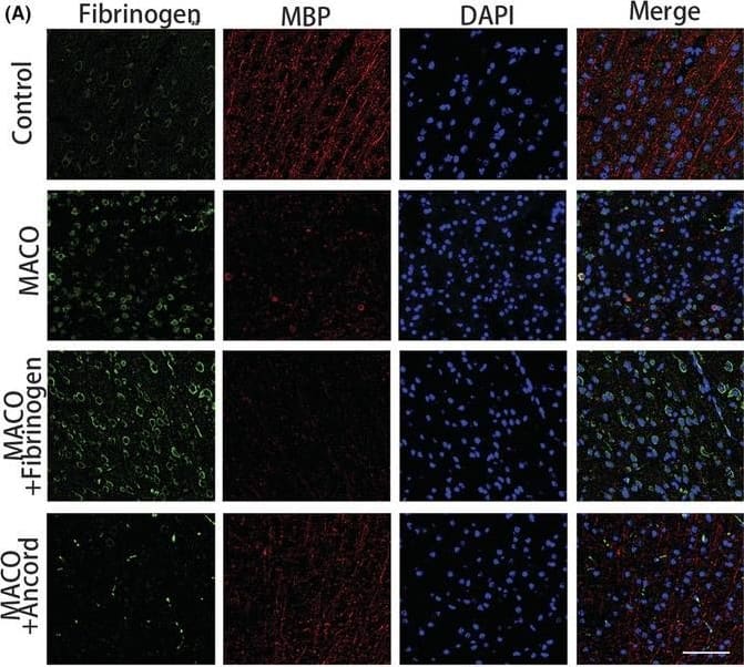 Fibrinogen inhibits remyelination after MCAO and disrupts OPC differentiation by activating ACVR1. (A) MBP (red) and fibrinogen (green) immunostaining in the peri‐infarct areas 7 days after MCAO. Scale bar, 50 μm. (B) Quantification of MBP immunoreactivity in the peri‐infarct areas per area. N = 6 mice. (C) MBP mRNA expression. N = 6 mice. (D) Transmission electron microscope analysis was performed on the peri‐infarct areas. Scale bar, 1 μm (top), 0.5 μm (bottom). (E) Quantification of the myelinated axons (% of total axons). N = 6 mice. (F) Volcano plot of differentially expressed genes. Red points represent upregulated genes, blue points represent downregulated genes, and gray points represent the unchanged genes. (G) Heatmap of differentially expressed genes in untreated OPCs and fibrinogen‐treated OPCs. N = 3 per group. (H) The verification of ACVR1 mRNA expression. N = 6 per group. Data are presented as mean +/- SEM, one‐way ANOVA, or unpaired Student's t‐test, ***p < 0.001. Image collected and cropped by CiteAb from the following open publication (//pubmed.ncbi.nlm.nih.gov/36756722), licensed under a CC-BY license. Not internally tested by Novus Biologicals.
