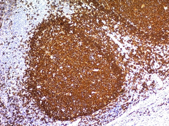 Formalin-fixed, paraffin-embedded human Tonsil stained with CD20 Antibody (L26).