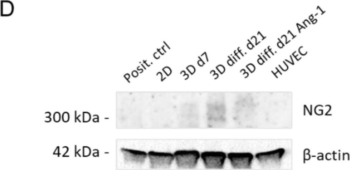 Differentiation of hASCs towards endothelial cells (ECs) in NFC hydrogel. (A) Differentiation of hASCs in 0.125% NFC hydrogel in endothelial growth medium for 21 days. Scale bars, 100 um (d1) and 50 um (d10, d21). (B) Differentiated cells in 0.125% NFC hydrogel on d7 showing branching of cellular structures (arrows). Scale bars, 25 um. (C) Western blot showing expression of endothelial specific marker CD31 and alpha-smooth muscle actin ( alpha -SMA) in hASCs vs. human umbilical vein endothelial cells (HUVEC) (n = 3, 1 technical replicate). (D) Western blot of pericyte marker NG2 in hASCs and HUVECs. (E) Quantification of NG2 expression (n = 3, 1 technical replicate). * p < 0.05. Ang-1, angiopoietin-1; diff., differentiated cells. Image collected and cropped by CiteAb from the following open publication (//pubmed.ncbi.nlm.nih.gov/36289846), licensed under a CC-BY license. Not internally tested by Novus Biologicals.