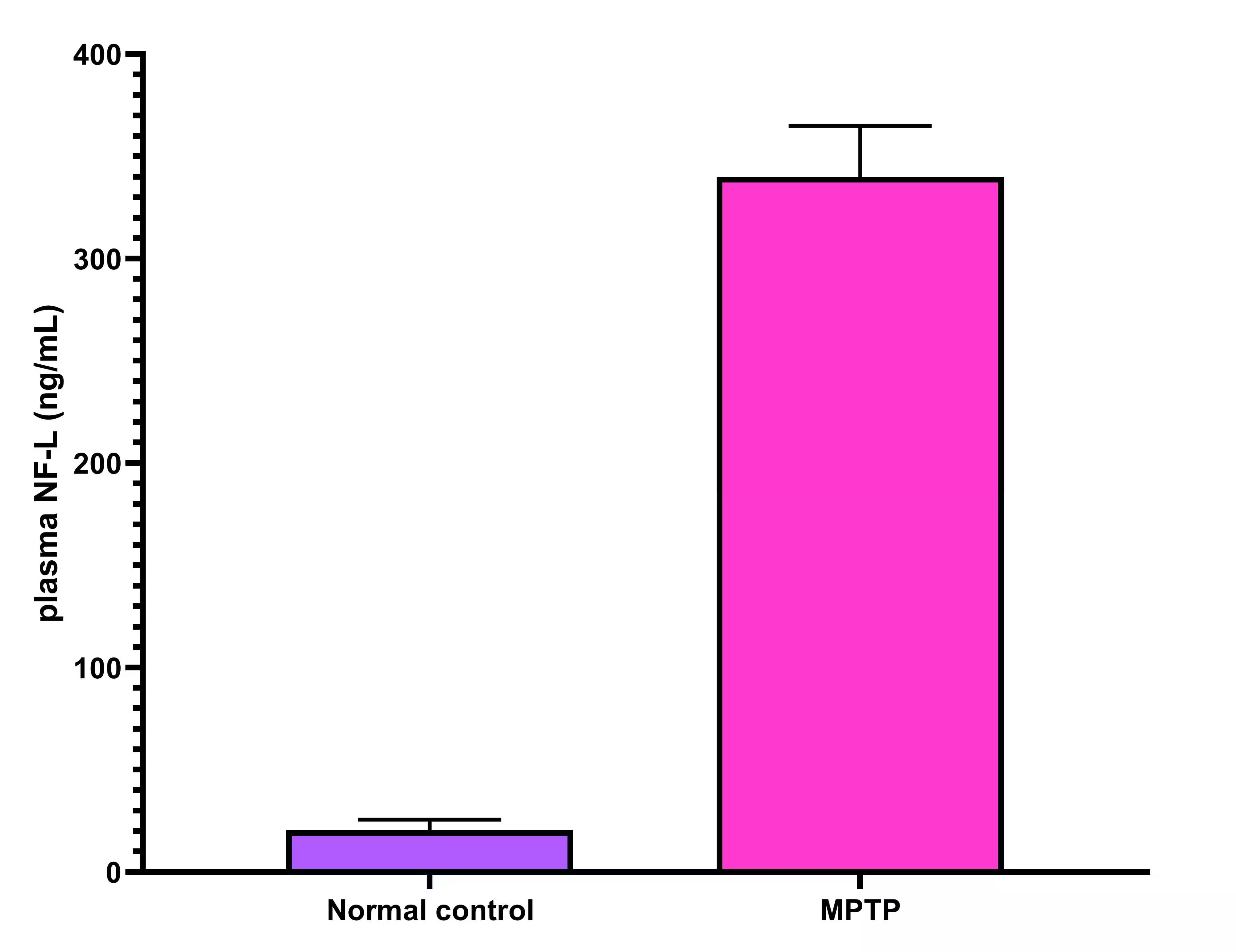 ELISA: Rat NF-L ELISA Kit (Colorimetric) [NBP2-81185] - Image from a verified customer review.