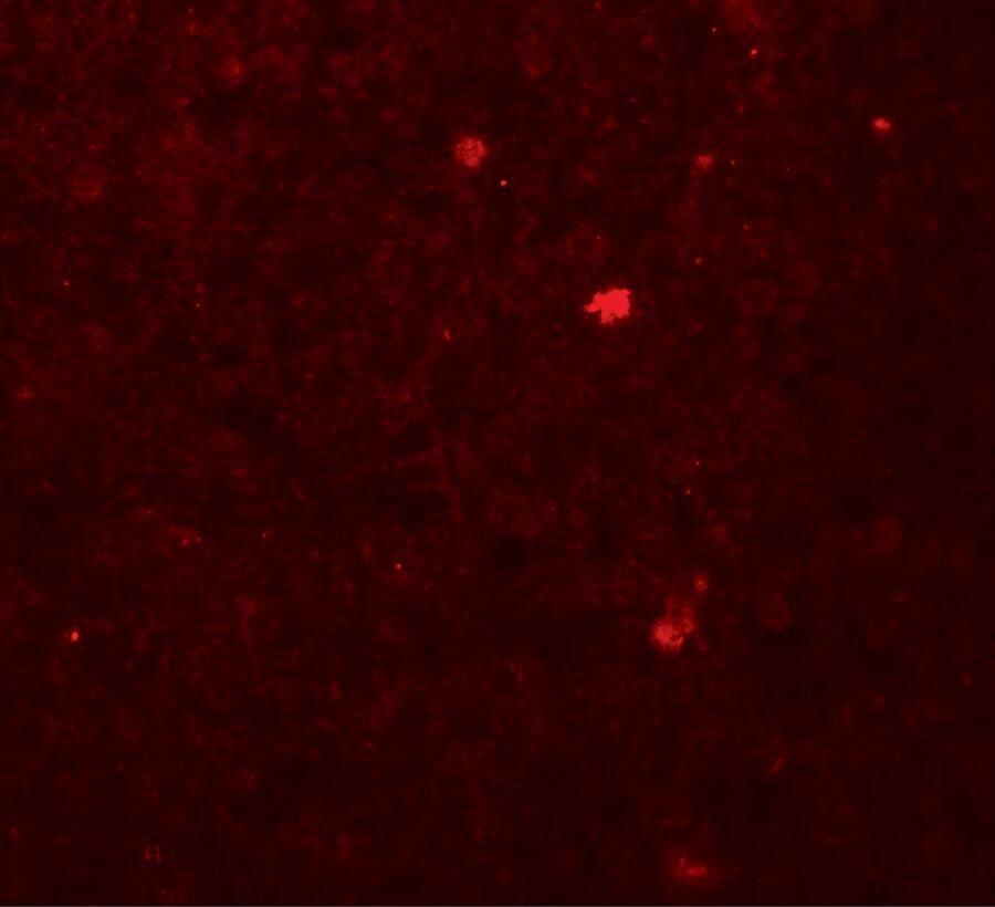 Immunocytochemistry/ Immunofluorescence: ROBLD3 Antibody - BSA Free [NBP2-81696] - Immunofluorescence of ROBLD3 in human spleen tissue with ROBLD3 antibody at 20 u/mL.