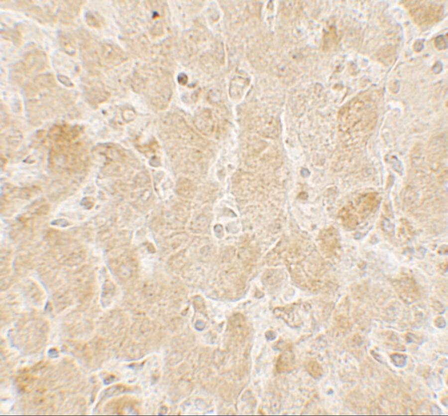 Immunohistochemistry: ROBLD3 Antibody - BSA Free [NBP2-81696] - Immunohistochemistry of ROBLD3 in human spleen tissue with ROBLD3 antibody at 5 u/mL.