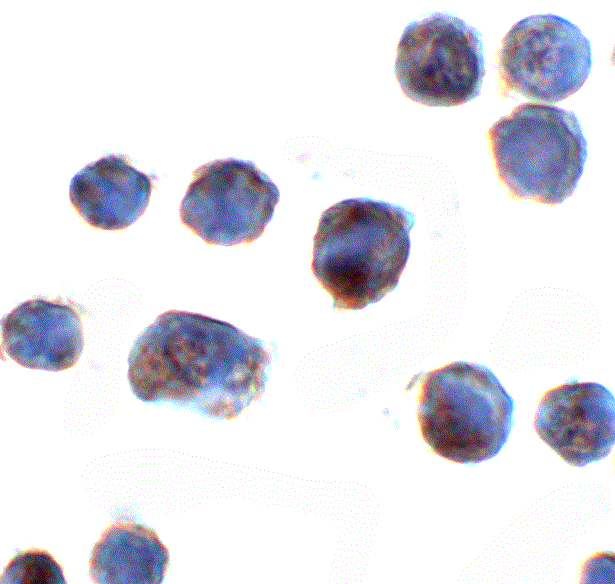Immunocytochemistry/ Immunofluorescence: AKAIN1 Antibody - BSA Free [NBP2-81698] - Immunocytochemistry of AKAIN1 in HeLa cells with AKAIN1 antibody at 2 ug/mL.