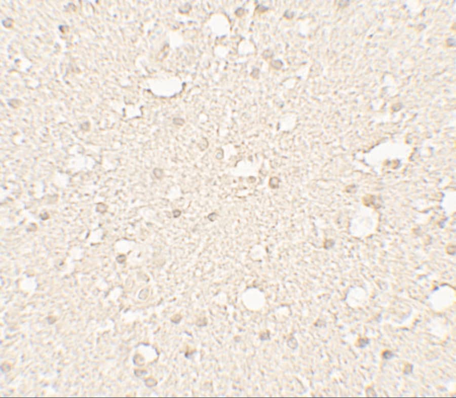 Immunohistochemistry: alpha Tubulin 3c Antibody - BSA Free [NBP2-81702] - Immunohistochemistry of alpha Tubulin 3c in human brain tissue with alpha Tubulin 3c antibody at 5 ug/mL.