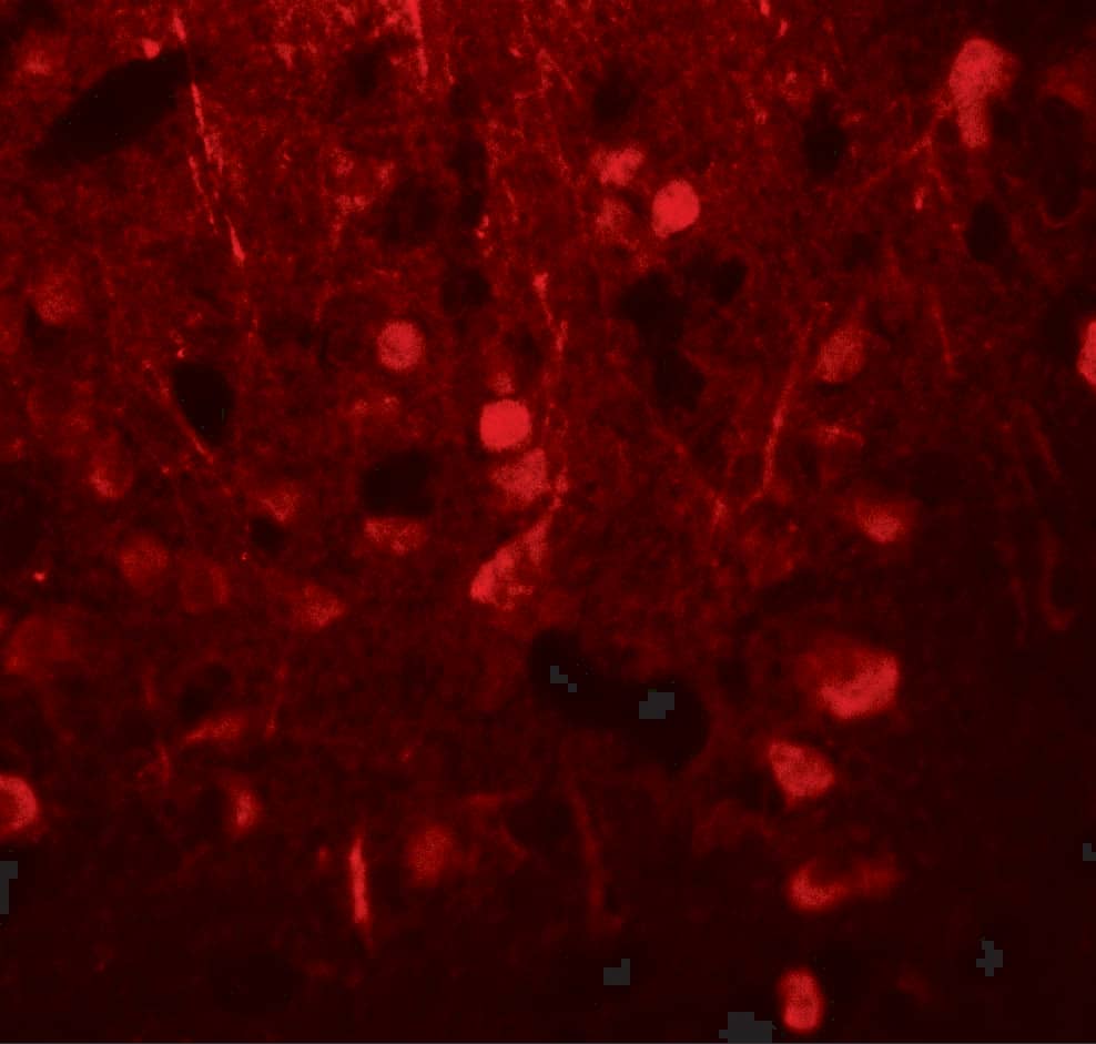 Immunocytochemistry/ Immunofluorescence: alpha Tubulin 3c Antibody - BSA Free [NBP2-81702] - Immunofluorescence of alpha Tubulin 3c in human brain tissue with alpha Tubulin 3c antibody at 20 ug/mL.
