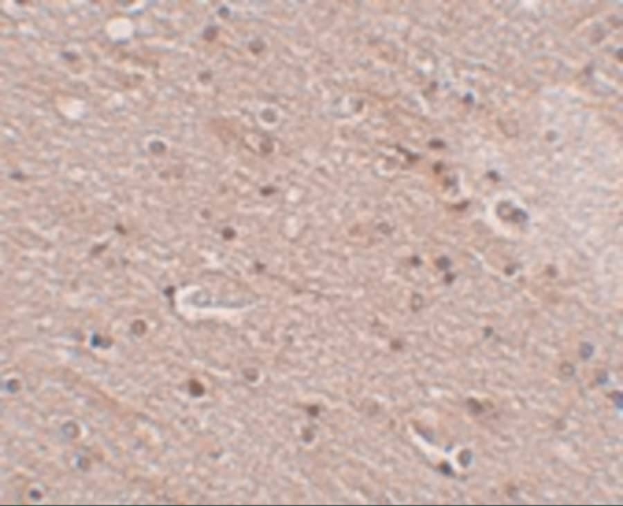 Immunohistochemistry ANO2 Antibody - BSA Free