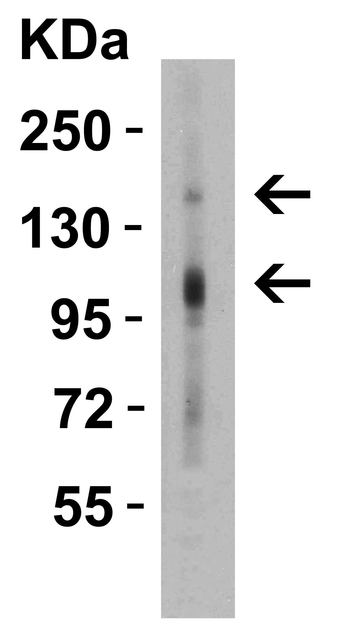 Western Blot: CRB2 Antibody - BSA Free [NBP2-81710] - WB Validation  in Human Kidney Loading: 15 ug of tissue lysate Antibodies:  CRB2 , 1 ug/mL , 1 h incubation at RT in 5% NFDM/TBST.Secondary: Goat Anti-Rabbit IgG HRP conjugate at 1:10000 dilution.