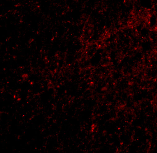 Immunocytochemistry/ Immunofluorescence: DLGAP3 Antibody - BSA Free [NBP2-81713] - Immunofluorescence of DLGAP3 in human brain tissue with DLGAP3 antibody at 20 ug/mL.