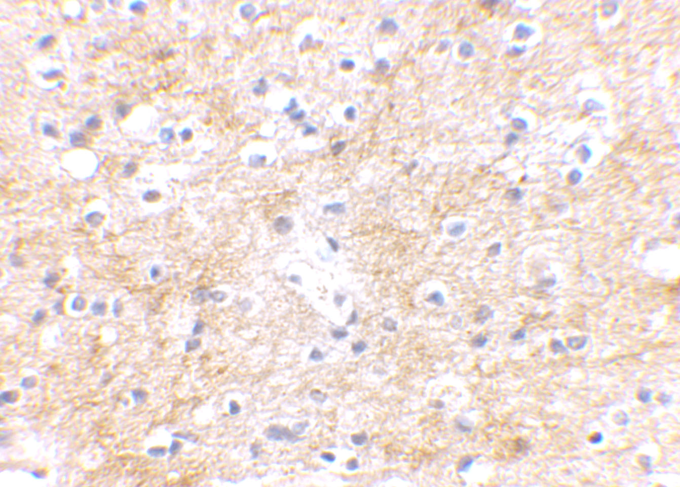 Immunohistochemistry: DLGAP3 Antibody - BSA Free [NBP2-81713] - Immunohistochemical staining of human brain tissue using DLGAP3 antibody at 2.5 u/mL.