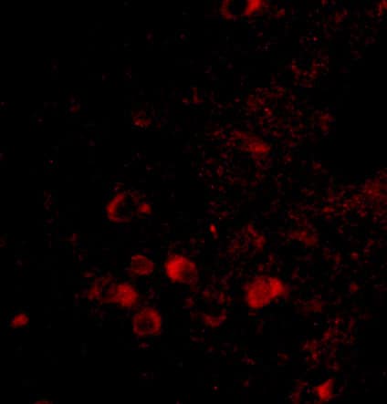 Immunocytochemistry/ Immunofluorescence: ELOVL6 Antibody - BSA Free [NBP2-81714] - Immunofluorescence of ELOVL6 in Human Brain tissue with ELOVL6 antibody at 20 u/mL.