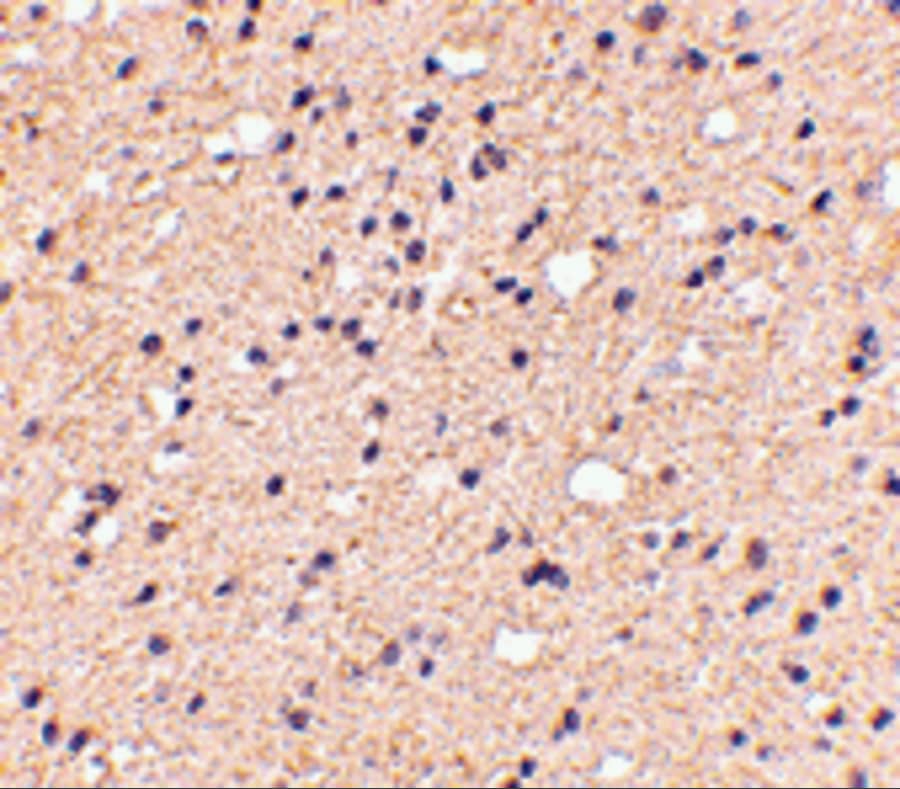 Immunohistochemistry: ELOVL6 Antibody - BSA Free [NBP2-81714] - Immunohistochemistry of ELOVL6 in human brain tissue with ELOVL6 antibody at 5 u/mL.