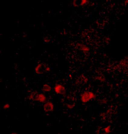 Immunocytochemistry/ Immunofluorescence: ELOVL6 Antibody - BSA Free [NBP2-81714] - Immunofluorescence of ELOVL6 in Human Brain tissue with ELOVL6 antibody at 20 ug/mL.