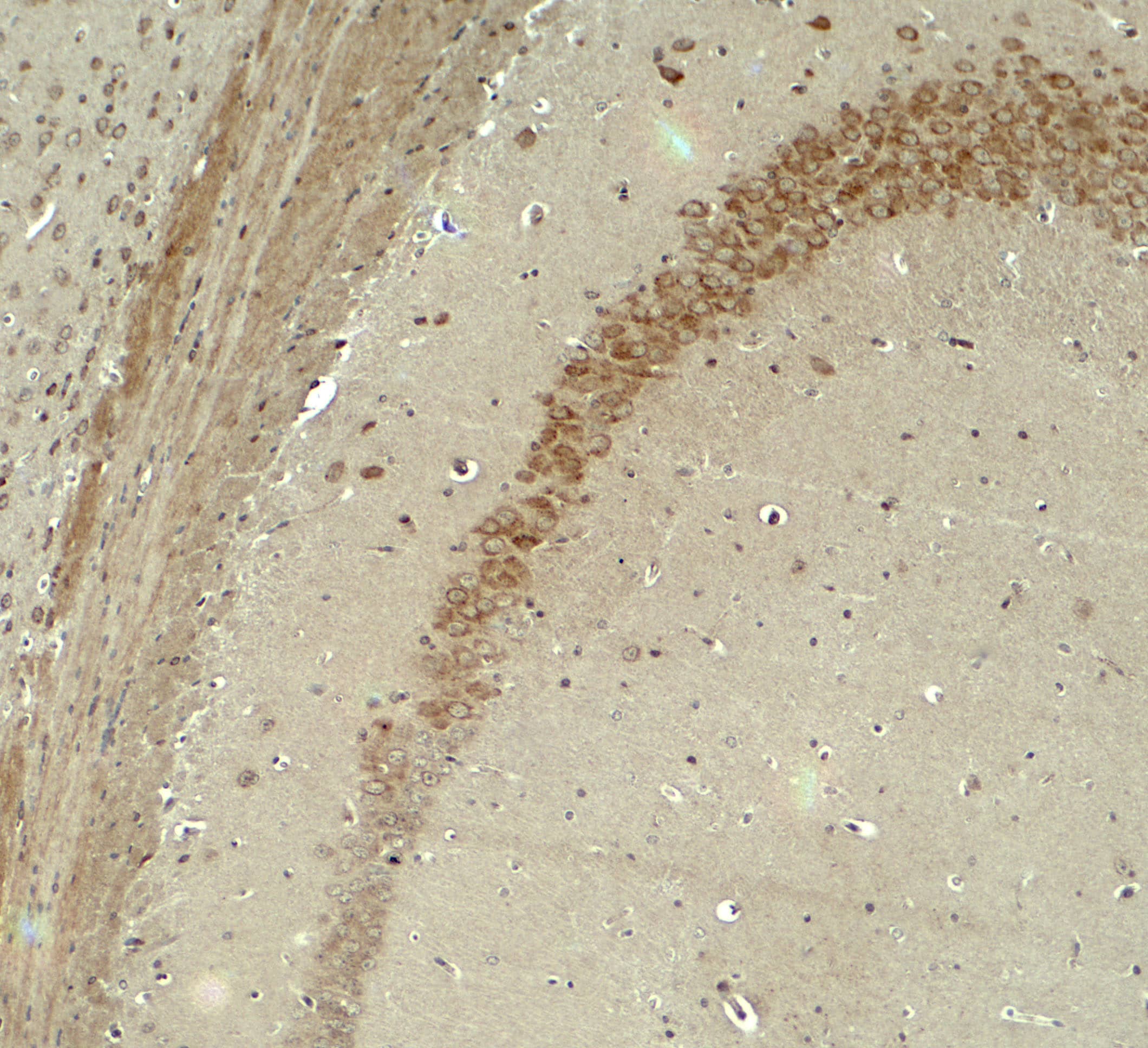 Immunohistochemistry IQSEC2 Antibody - BSA Free
