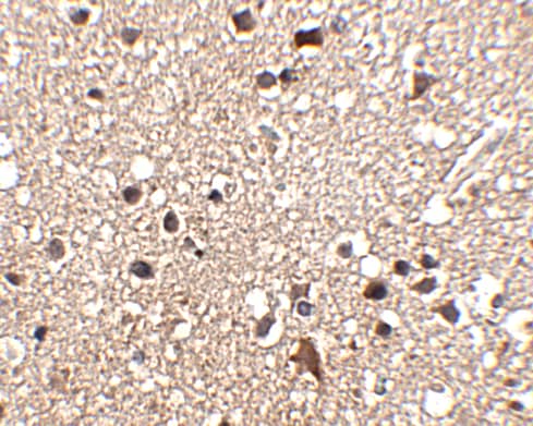 Immunohistochemistry JPH3 Antibody - BSA Free