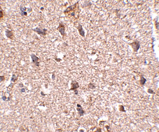 Immunohistochemistry: JPH3 Antibody - BSA Free [NBP2-81726] - Immunohistochemistry of JPH3 in human brain tissue with JPH3 antibody at 2.5 u/mL.