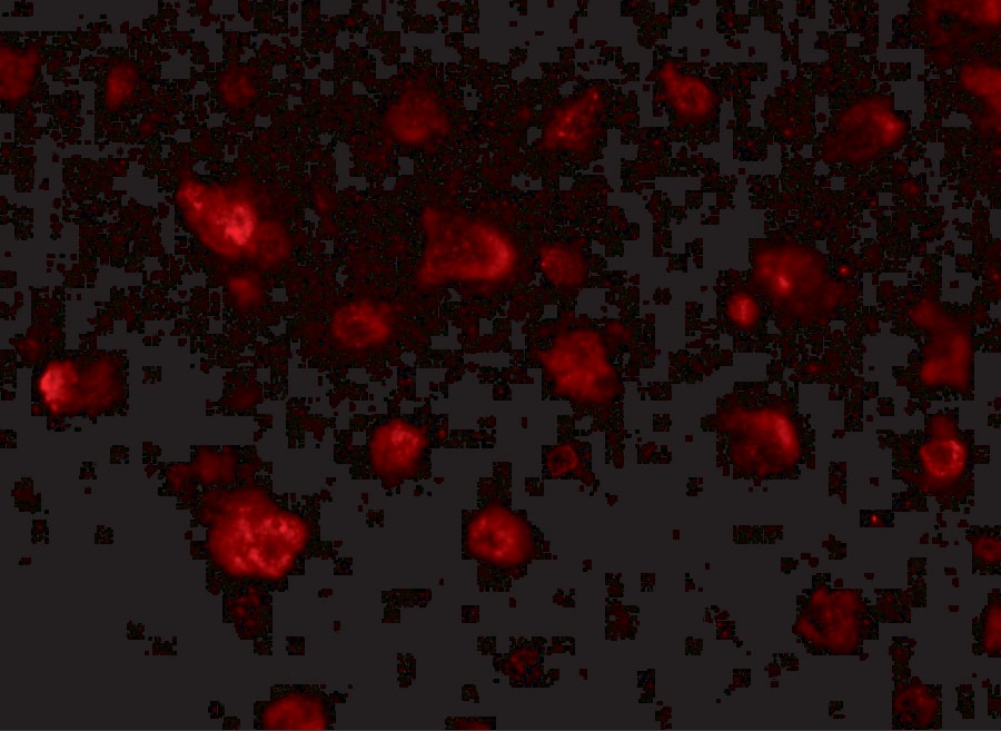 Immunocytochemistry/ Immunofluorescence: JPH3 Antibody - BSA Free [NBP2-81726] - Immunofluorescence of JPH3 in human brain tissue with JPH3 antibody at 20 ug/mL.