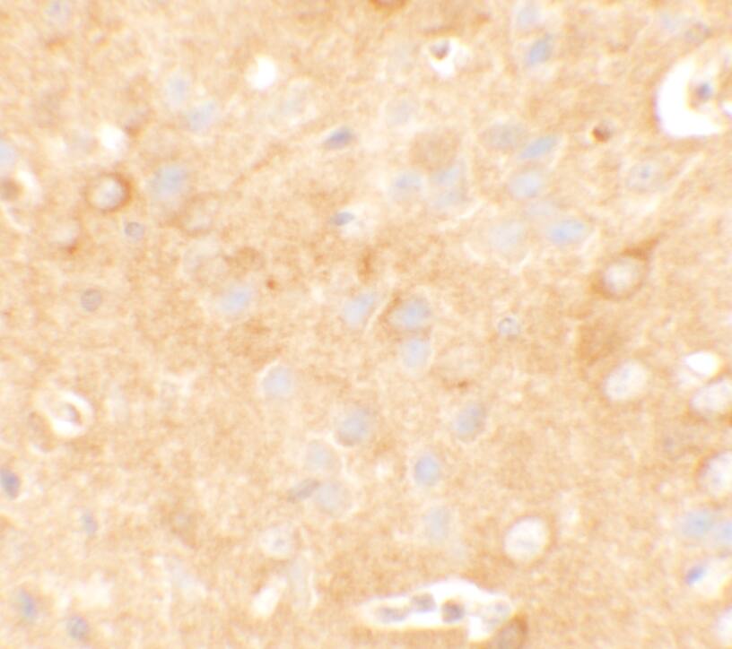 Immunohistochemistry KCNK12 Antibody - BSA Free