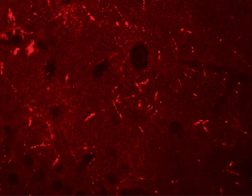 Immunocytochemistry/ Immunofluorescence KCNK12 Antibody - BSA Free