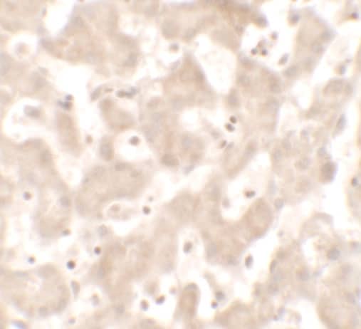 Immunohistochemistry: KHDC1 Antibody - BSA Free [NBP2-81729] - Immunohistochemistry of KHDC1 in human liver tissue with KHDC1 antibody at 5 u/mL.