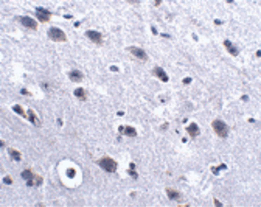 Immunohistochemistry: LRFN2 Antibody - BSA Free [NBP2-81731] - Immunohistochemistry of LRFN2 in mouse brain tissue with LRFN2 antibody at 2.5 u/mL.