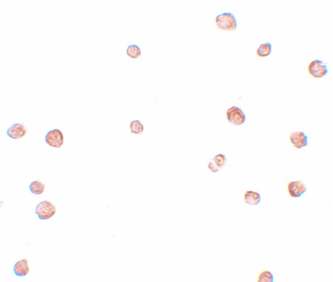 Immunocytochemistry/ Immunofluorescence: LRRC19 Antibody - BSA Free [NBP2-81732] - Immunocytochemistry of LRCC19 in K562 cells with LRCC19 antibody at 2.5 ug/mL.