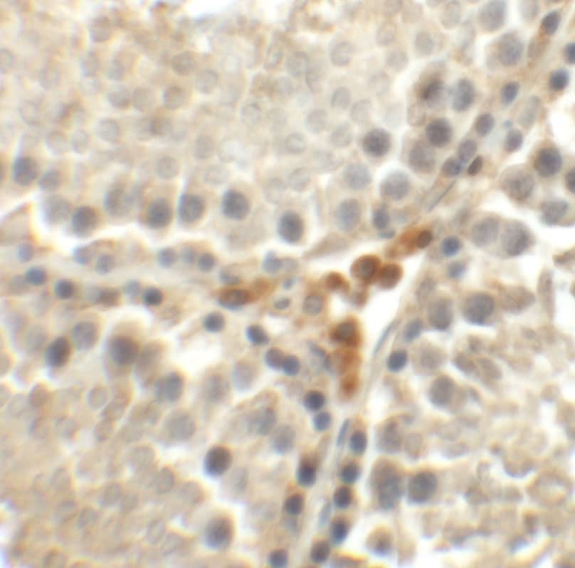 Immunohistochemistry: MEIG1 Antibody - BSA Free [NBP2-81733] - Immunohistochemistry of MEIG1 in rat testis tissue with MEIG1 antibody at 5 u/mL.