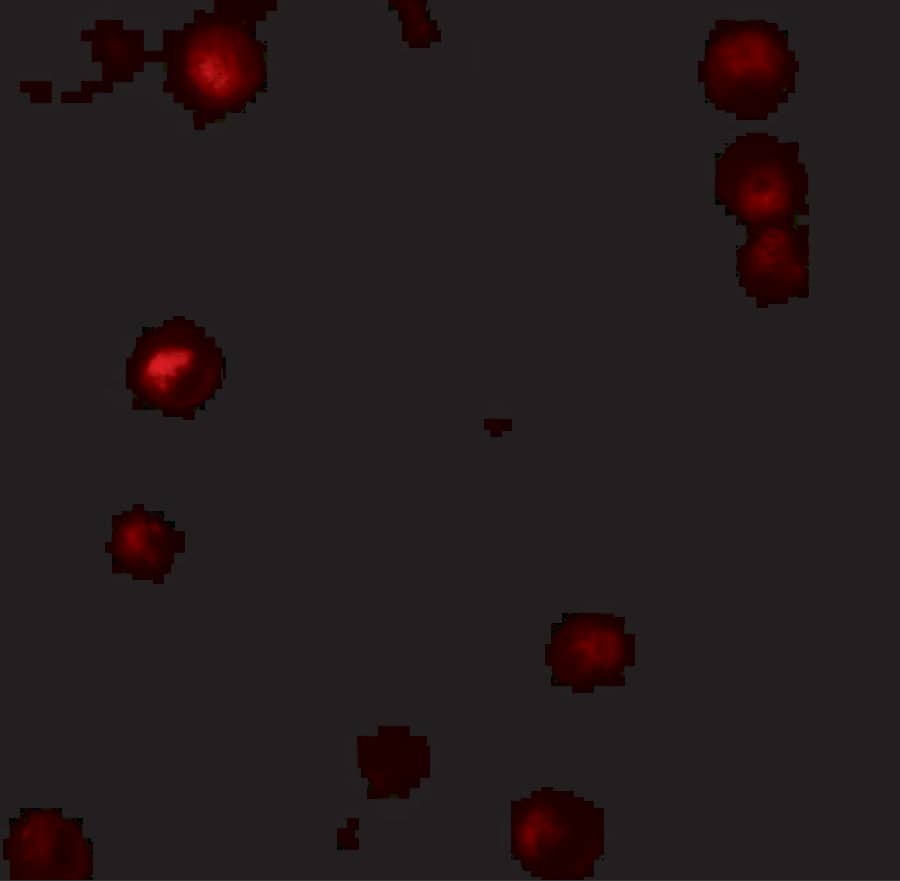 Immunocytochemistry/ Immunofluorescence: Thymopoietin/LAP2 Antibody - BSA Free [NBP2-81736] - Immunofluorescence of Thymopoietin/LAP2 in HeLa cells with Thymopoietin/LAP2 antibody at 5 u/mL.