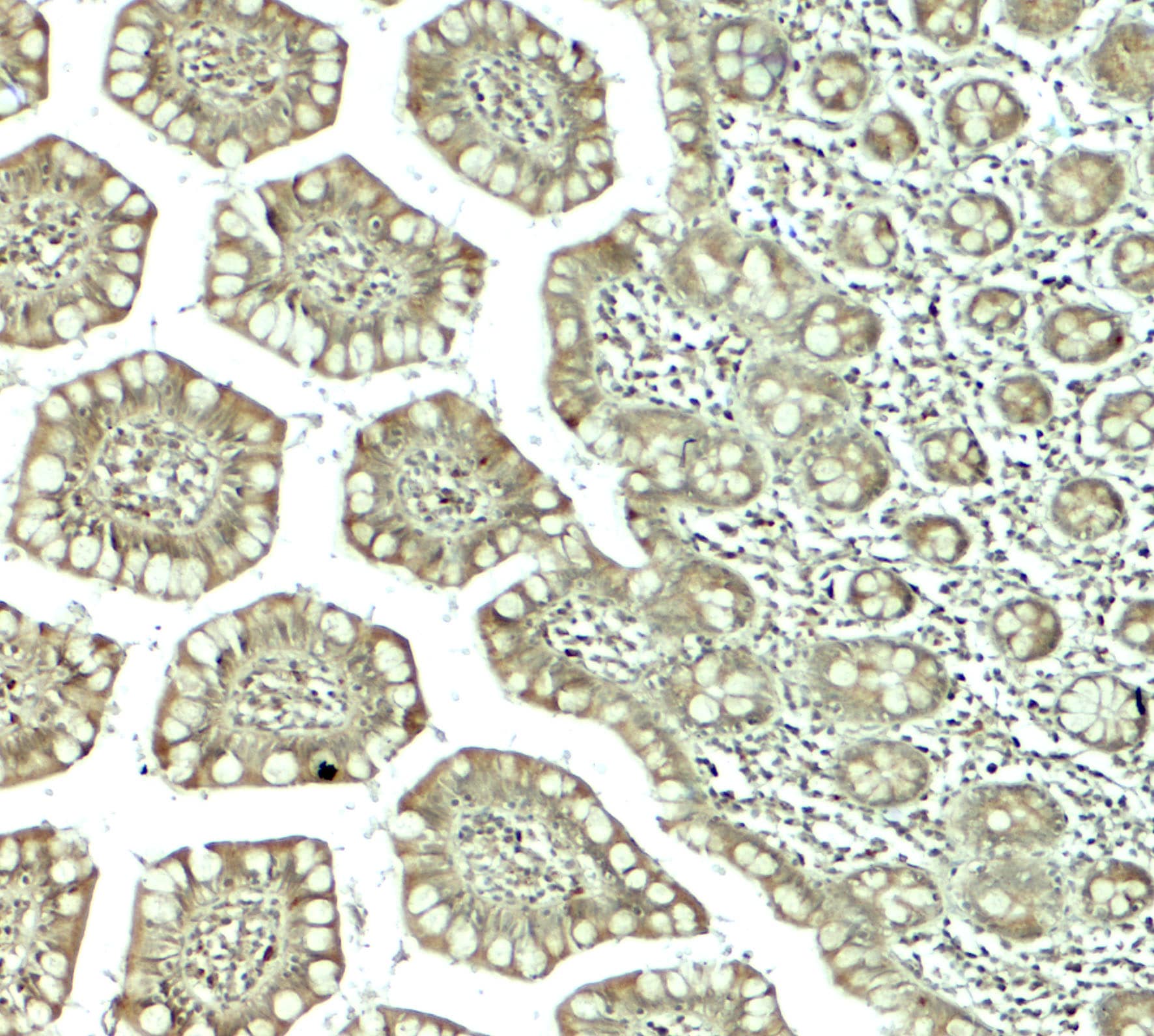 Immunohistochemistry: CTHRC1 Antibody - BSA Free [NBP2-81744] - Immunohistochemistry of CTHRC1 in human small intestine tissue with CTHRC1 antibody at 5 ug/mL.