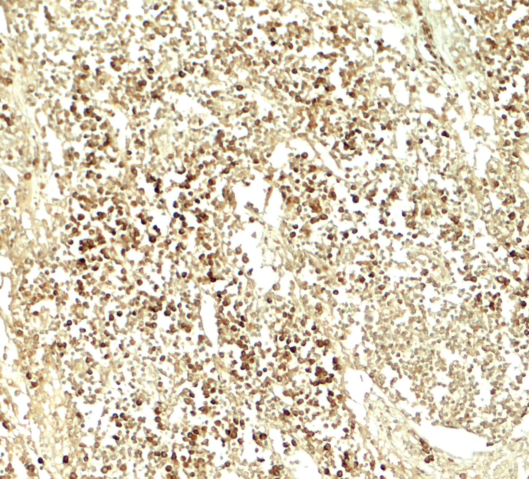 Immunohistochemistry: E2F3 Antibody - BSA Free [NBP2-81745] - Immunohistochemistry of E2F3 in human lymph node tissue with E2F3 antibody at 5 ug/ml.