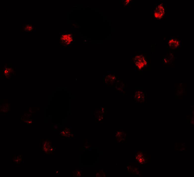 Immunocytochemistry/ Immunofluorescence: N-Deacetylase/N-Sulfotransferase 2/NDST2 Antibody - BSA Free [NBP2-81747] - Immunofluorescence of N-Deacetylase/N-Sulfotransferase 2/NDST2 in Daudi cells with N-Deacetylase/N-Sulfotransferase 2/NDST2 antibody at 20 u/ml.