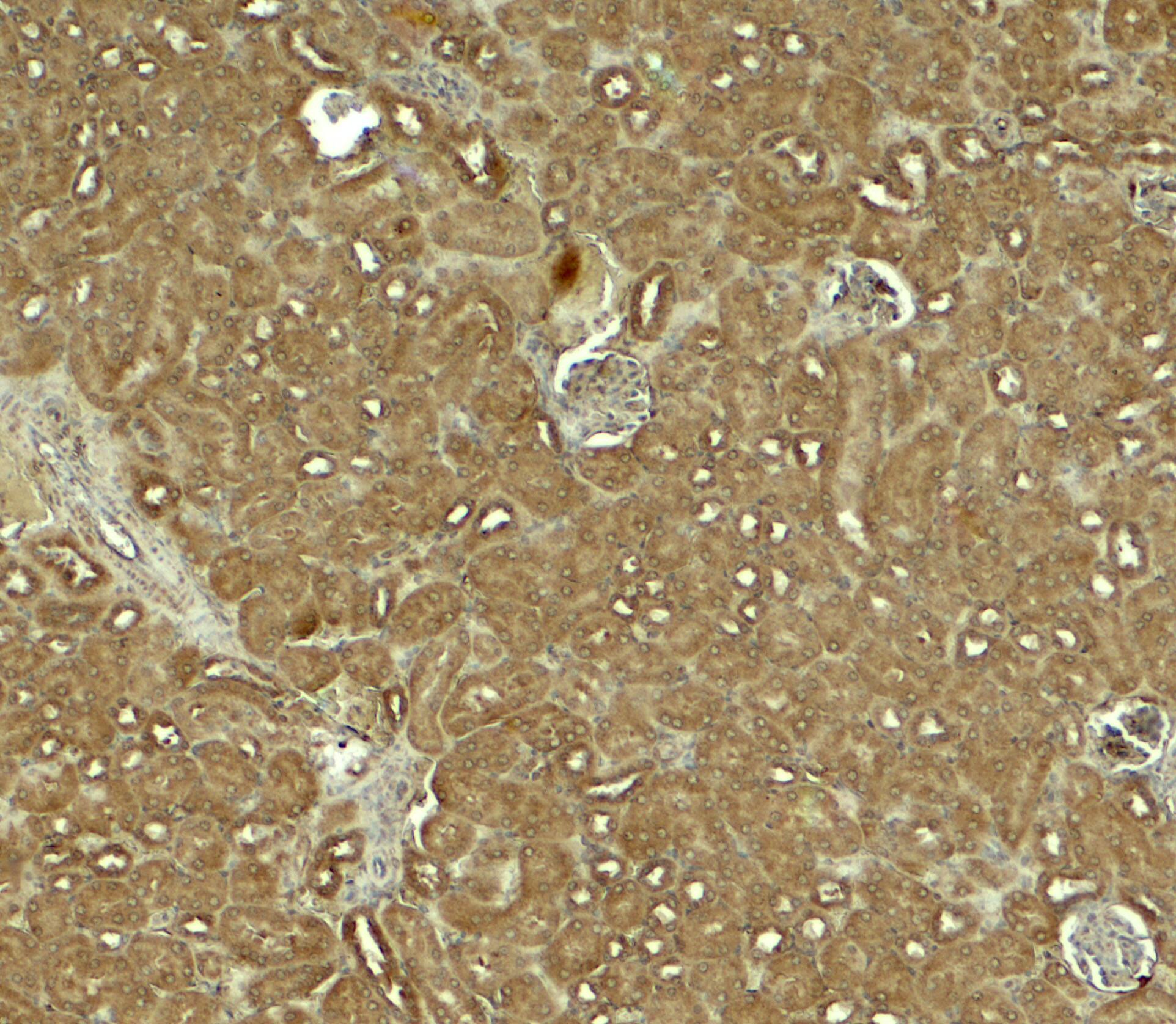 Immunohistochemistry: NOSTRIN Antibody - BSA Free [NBP2-81749] - Immunohistochemistry of NOSTRIN in mouse kidney tissue with NOSTRIN antibody at 5 ug/ml.