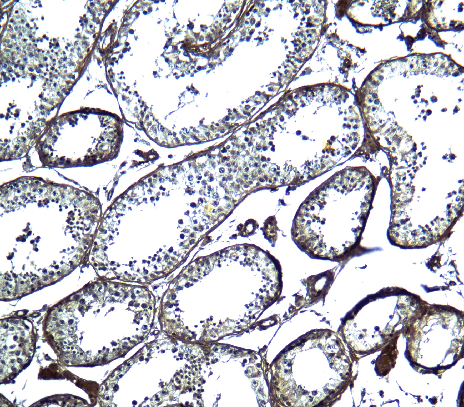 Immunohistochemistry: FAT10 Antibody - BSA Free [NBP2-81752] - Immunohistochemistry of FAT10 in human testis tissue with FAT10 antibody at 5 ug/mL.