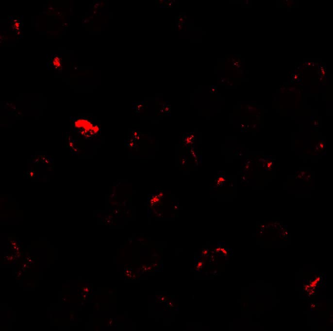 Immunocytochemistry/ Immunofluorescence: Mind Bomb 1/MIB1 Antibody - BSA Free [NBP2-81754] - Immunofluorescence of Mind Bomb 1/MIB1 in A431 cells with Mind Bomb 1/MIB1 antibody at 20 ug/mL.