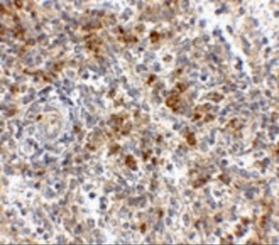 Immunohistochemistry: OCC1 Antibody - BSA Free [NBP2-81755] - Immunohistochemistry of OCC1 in human spleen tissue with OCC1 antibody at 2.5 u/mL.