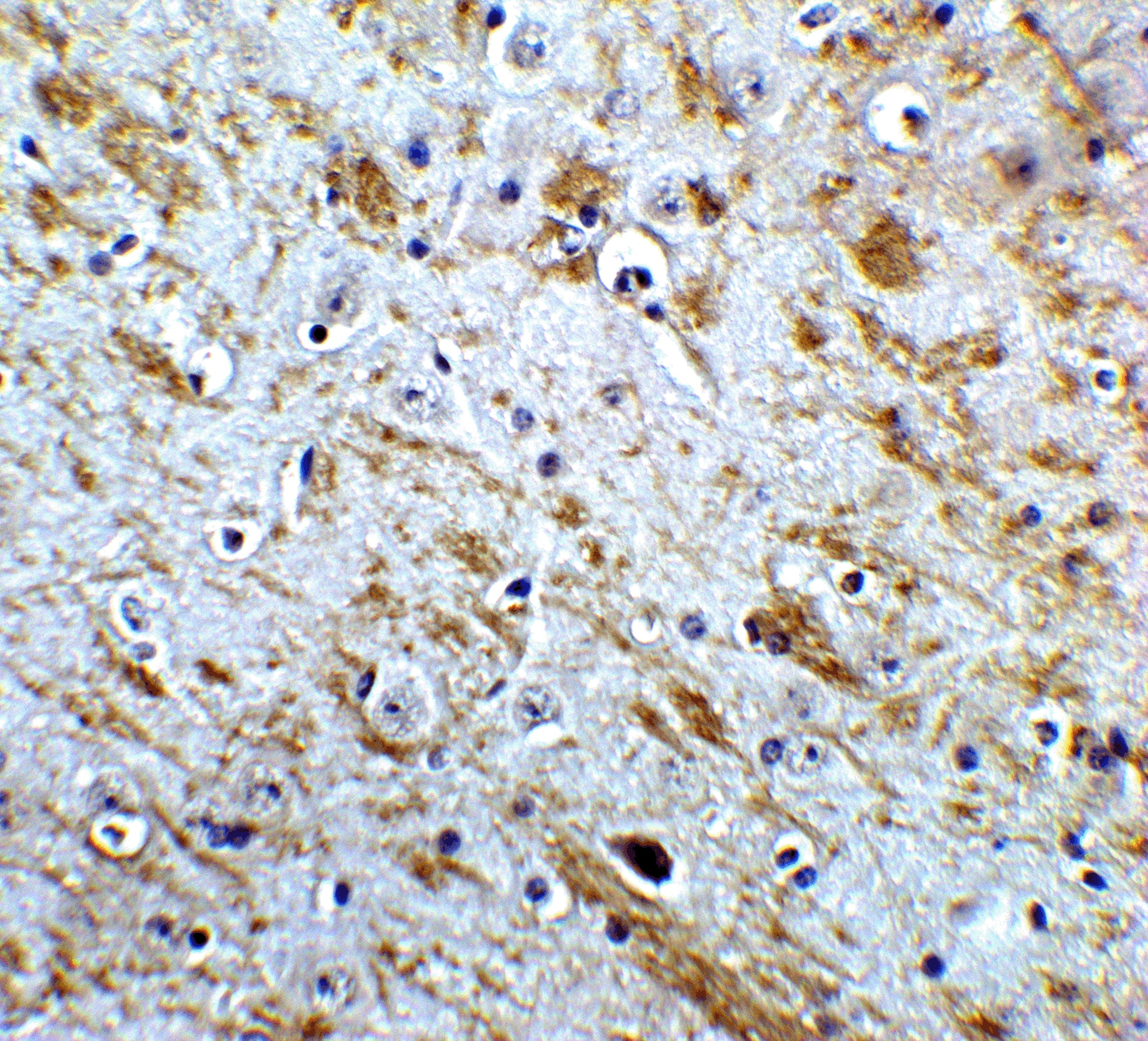 Immunohistochemistry: NELF Antibody - BSA Free [NBP2-81759] - Immunohistochemistry of NELF in mouse brain tissue with NELF Antibody at 5 u/mL.