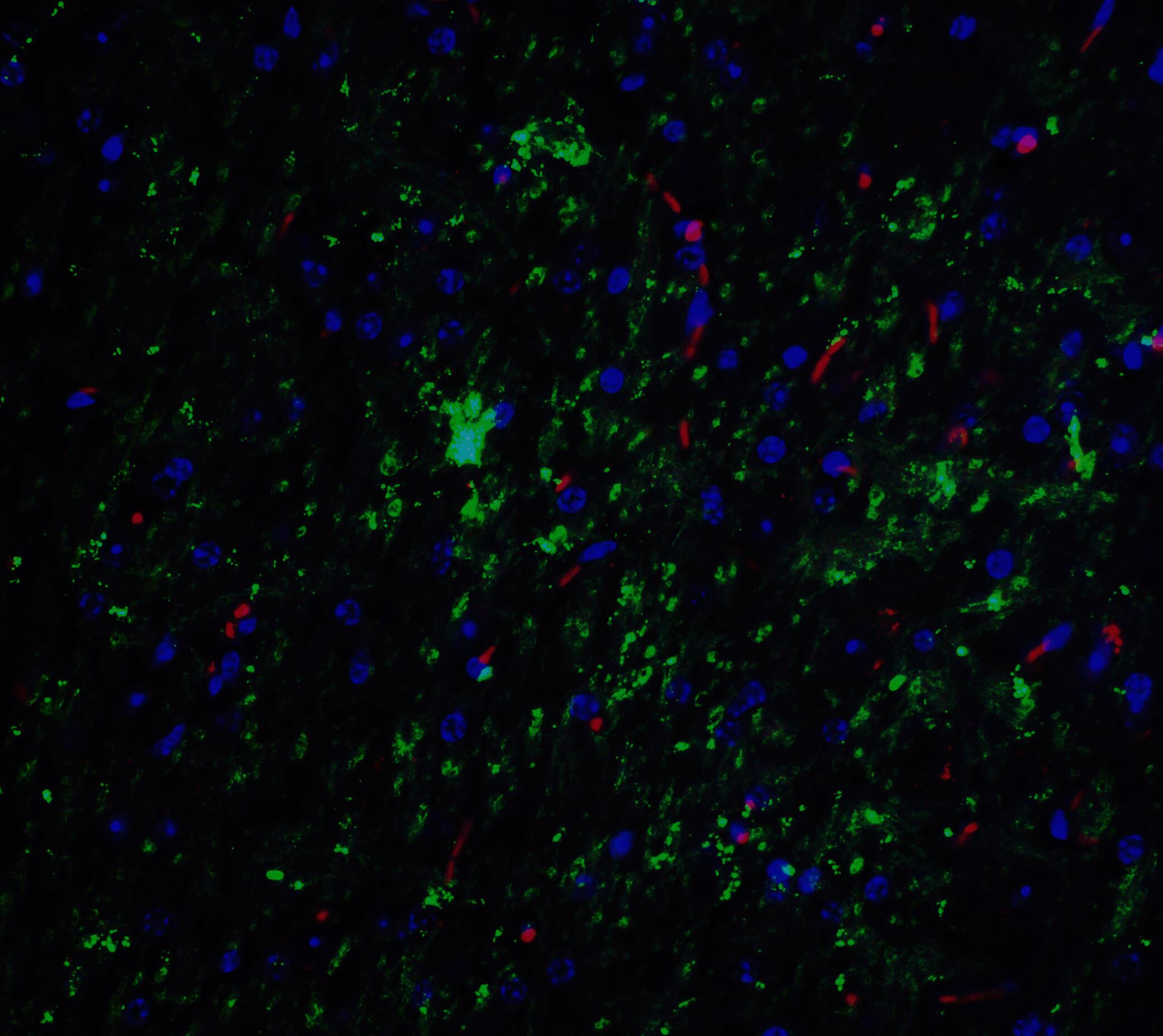 Immunocytochemistry/ Immunofluorescence: NELF Antibody - BSA Free [NBP2-81759] - Immunofluorescence of NELF in mouse brain tissue with NELF Antibody at 20 u/mL.Green: NELF antibody   Red: Phylloidin staining Blue: DAPI staining